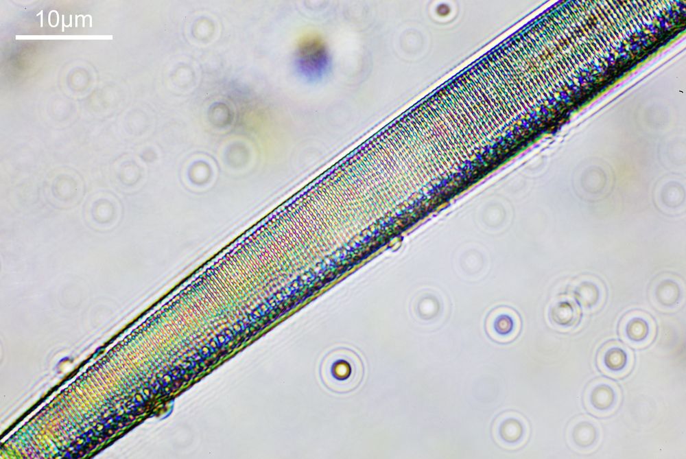 diatoms under microscope 400x